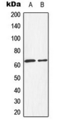 Anti-HEXB antibody used in Western Blot (WB). GTX55224