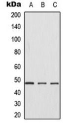 Anti-Casein Kinase 1 gamma antibody used in Western Blot (WB). GTX55230