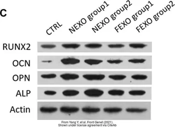 Anti-Osteocalcin antibody used in Western Blot (WB). GTX55255