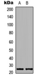 Anti-KDELR2 antibody used in Western Blot (WB). GTX55288