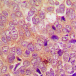 Anti-UBR1 antibody used in IHC (Paraffin sections) (IHC-P). GTX55291