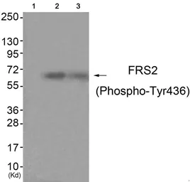 Anti-FRS2 (phospho Tyr436) antibody used in Western Blot (WB). GTX55340