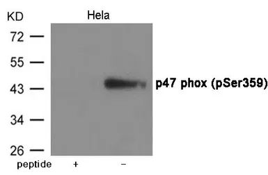 Anti-NCF1 (phospho Ser359) antibody used in Western Blot (WB). GTX55429