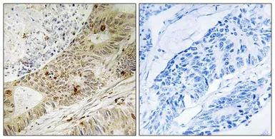 Anti-ATRIP (phospho Ser224) antibody used in IHC (Paraffin sections) (IHC-P). GTX55441