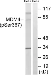 Anti-MDMX / MDM4 (phospho Ser367) antibody used in Western Blot (WB). GTX55445