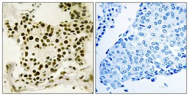 Anti-UBTF (phospho Ser484) antibody used in IHC (Paraffin sections) (IHC-P). GTX55450
