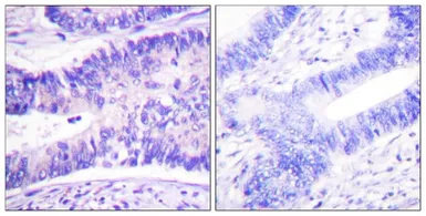 Anti-WAVE1 (phospho Tyr125) antibody used in IHC (Paraffin sections) (IHC-P). GTX55451