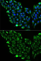Anti-ACADS antibody used in Immunocytochemistry/ Immunofluorescence (ICC/IF). GTX55489