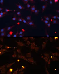 Anti-ADAMTS4 antibody used in Immunocytochemistry/ Immunofluorescence (ICC/IF). GTX55492
