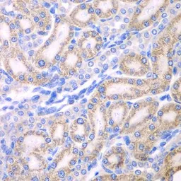 Anti-ALDH1A2 antibody used in IHC (Paraffin sections) (IHC-P). GTX55501