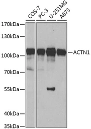 Anti-alpha Actinin 1 antibody used in Western Blot (WB). GTX55505