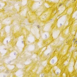 Anti-alpha Actinin 1 antibody used in IHC (Paraffin sections) (IHC-P). GTX55505