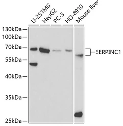 Anti-Antithrombin III antibody used in Western Blot (WB). GTX55514