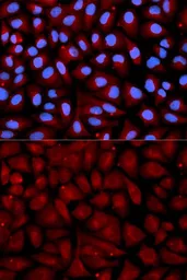 Anti-Antithrombin III antibody used in Immunocytochemistry/ Immunofluorescence (ICC/IF). GTX55514