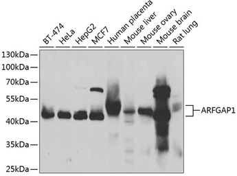 Anti-ARFGAP1 antibody used in Western Blot (WB). GTX55515