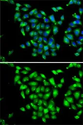 Anti-ARFGAP1 antibody used in Immunocytochemistry/ Immunofluorescence (ICC/IF). GTX55515