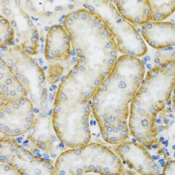 Anti-ARFGAP1 antibody used in IHC (Paraffin sections) (IHC-P). GTX55515