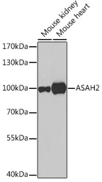 Anti-ASAH2 antibody used in Western Blot (WB). GTX55519