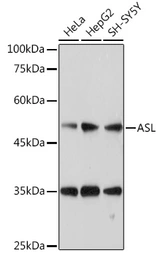 Anti-ASL antibody used in Western Blot (WB). GTX55520