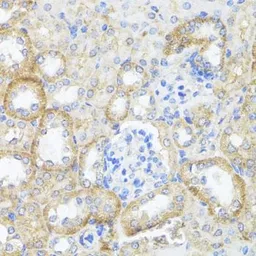 Anti-ASL antibody used in IHC (Paraffin sections) (IHC-P). GTX55520
