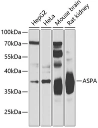 Anti-Aspartoacylase antibody used in Western Blot (WB). GTX55521