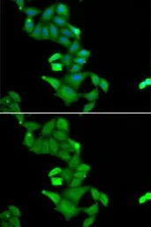 Anti-BLZF1 antibody used in Immunocytochemistry/ Immunofluorescence (ICC/IF). GTX55539