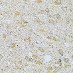 Anti-CaMKI gamma antibody used in IHC (Paraffin sections) (IHC-P). GTX55546