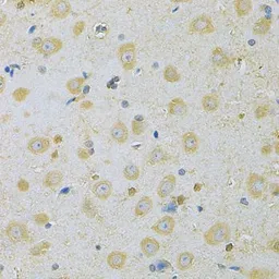 Anti-CaMKI gamma antibody used in IHC (Paraffin sections) (IHC-P). GTX55546