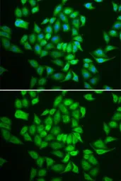 Anti-Casein Kinase 1 epsilon antibody used in Immunocytochemistry/ Immunofluorescence (ICC/IF). GTX55549