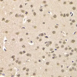 Anti-Casein Kinase 1 epsilon antibody used in IHC (Paraffin sections) (IHC-P). GTX55549