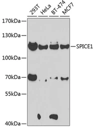 Anti-CCDC52 antibody used in Western Blot (WB). GTX55552