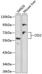 Anti-CES2 antibody used in Western Blot (WB). GTX55569