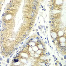 Anti-CES2 antibody used in IHC (Paraffin sections) (IHC-P). GTX55569
