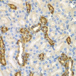 Anti-CNPY3 antibody used in IHC (Paraffin sections) (IHC-P). GTX55574