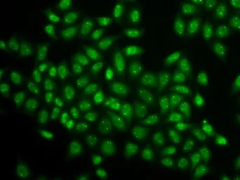 Anti-Coilin antibody used in Immunocytochemistry/ Immunofluorescence (ICC/IF). GTX55575