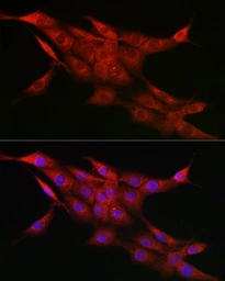 Anti-CYP1A1 antibody used in Immunocytochemistry/ Immunofluorescence (ICC/IF). GTX55582