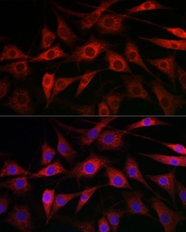 Anti-CYP1A1 antibody used in Immunocytochemistry/ Immunofluorescence (ICC/IF). GTX55582