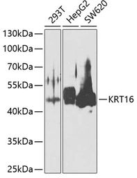 Anti-Cytokeratin 16 antibody used in Western Blot (WB). GTX55584