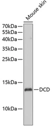Anti-DCD antibody used in Western Blot (WB). GTX55585