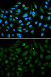 Anti-Decorin antibody used in Immunocytochemistry/ Immunofluorescence (ICC/IF). GTX55587