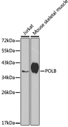 Anti-DNA polymerase beta antibody used in Western Blot (WB). GTX55594