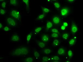 Anti-DR1 antibody used in Immunocytochemistry/ Immunofluorescence (ICC/IF). GTX55597