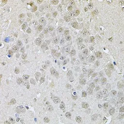 Anti-DR1 antibody used in IHC (Paraffin sections) (IHC-P). GTX55597
