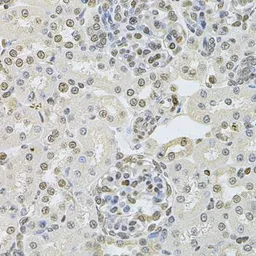 Anti-DR1 antibody used in IHC (Paraffin sections) (IHC-P). GTX55597