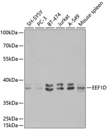 Anti-EEF1D antibody used in Western Blot (WB). GTX55601