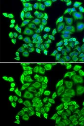 Anti-EEF1D antibody used in Immunocytochemistry/ Immunofluorescence (ICC/IF). GTX55601