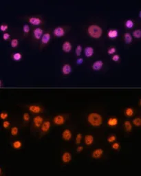 Anti-EFTUD2 antibody used in Immunocytochemistry/ Immunofluorescence (ICC/IF). GTX55602