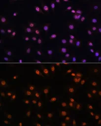 Anti-EFTUD2 antibody used in Immunocytochemistry/ Immunofluorescence (ICC/IF). GTX55602