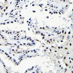 Anti-EFTUD2 antibody used in IHC (Paraffin sections) (IHC-P). GTX55602