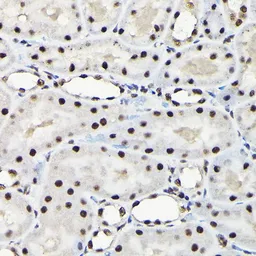 Anti-EFTUD2 antibody used in IHC (Paraffin sections) (IHC-P). GTX55602